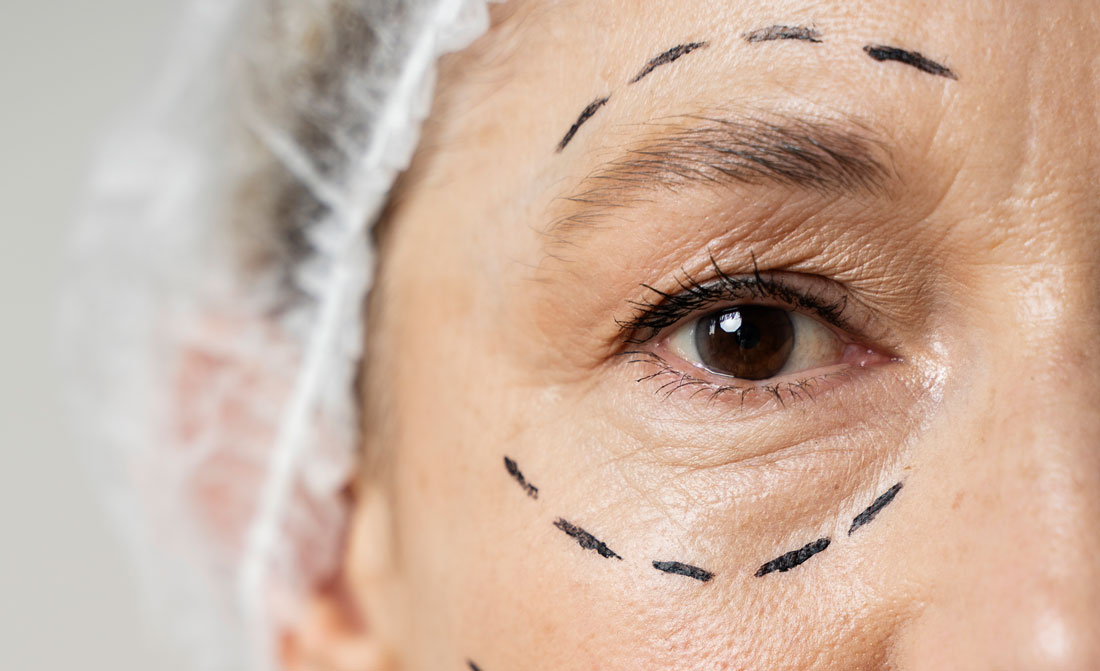 woman-with-marker-traces-face-close-up.jpg